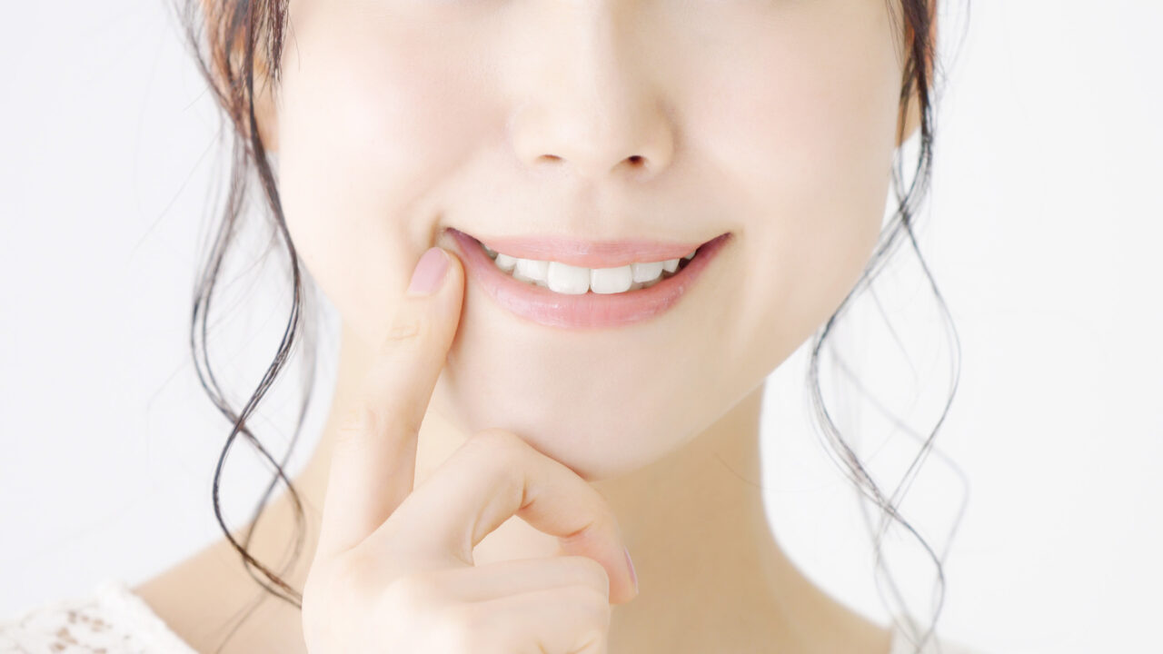 セラミック MI治療